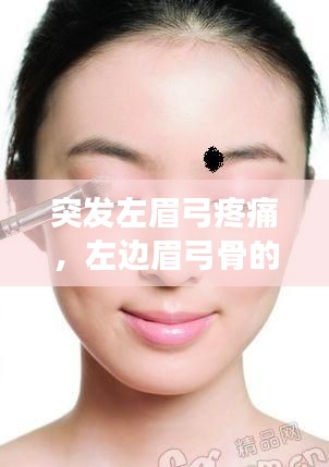 突发左眉弓疼痛,左边眉弓骨的位置疼怎么回事