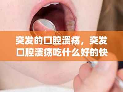 突发的口腔溃疡,突发口腔溃疡吃什么好的快