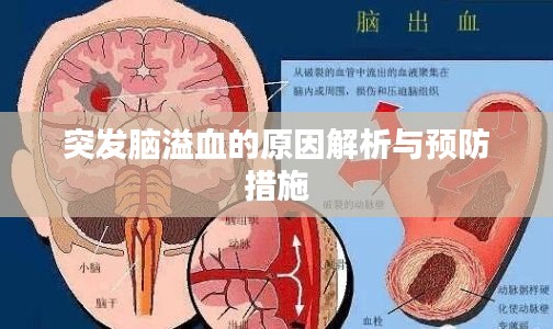 突发脑溢血的原因解析与预防措施